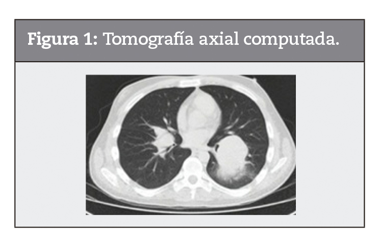 Tomografía axial computada.